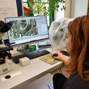 Determination of the number and size of stomata using transmitted light microscopy